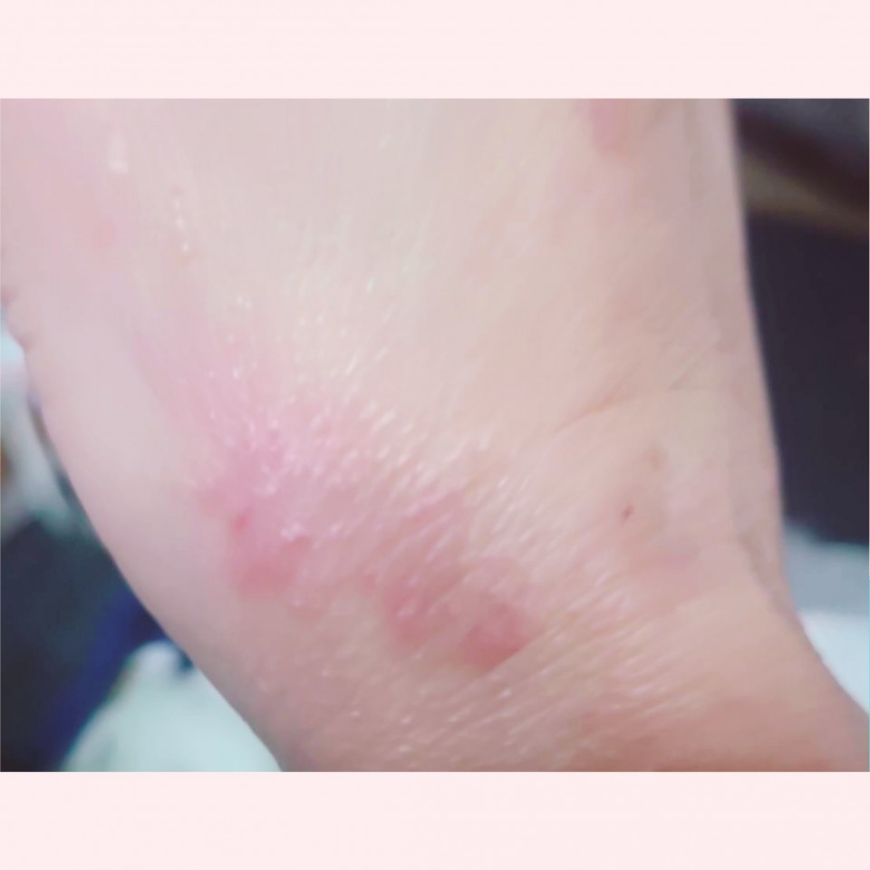 アップロード画像